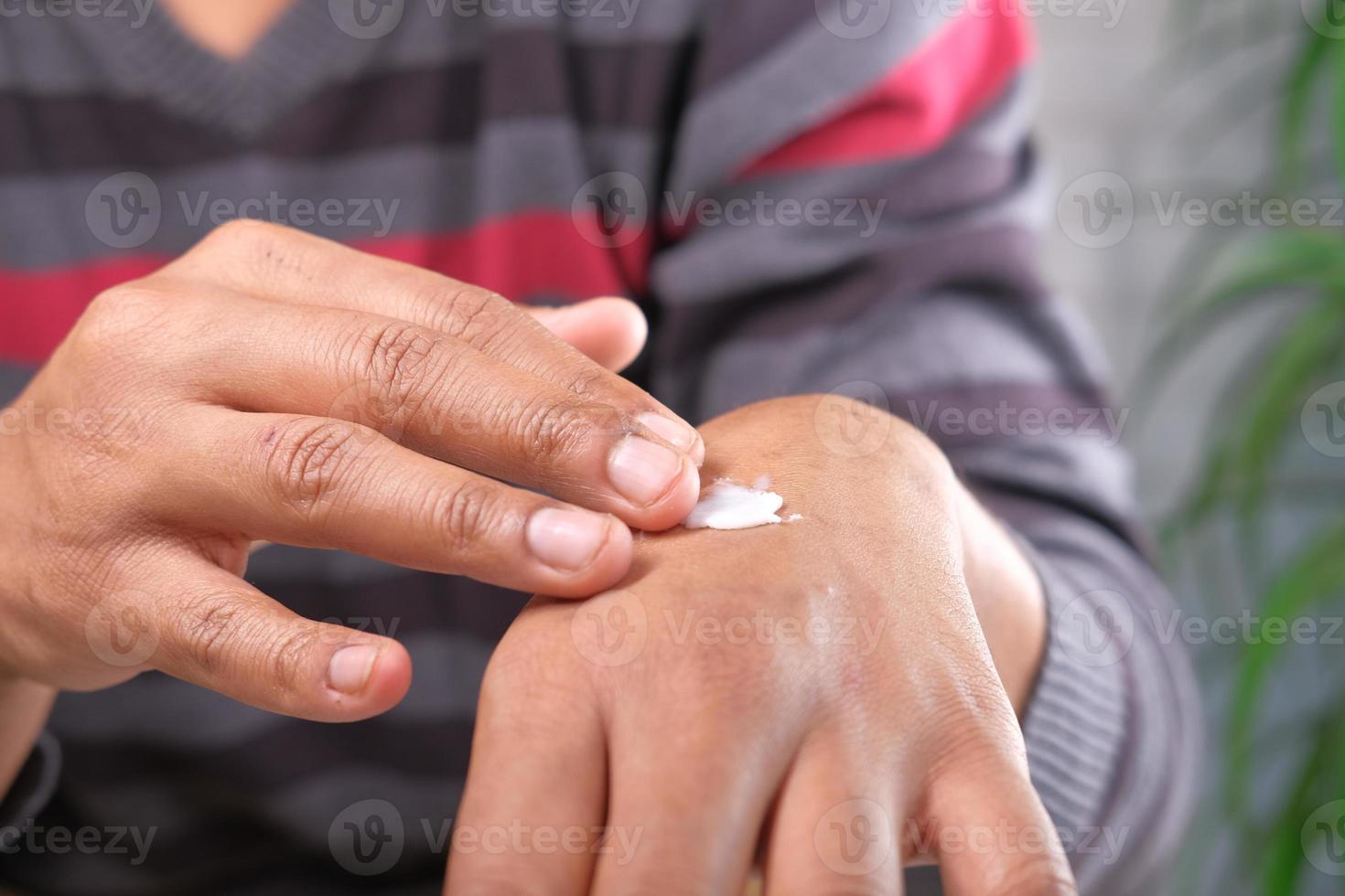 Man applying cream onto skin photo