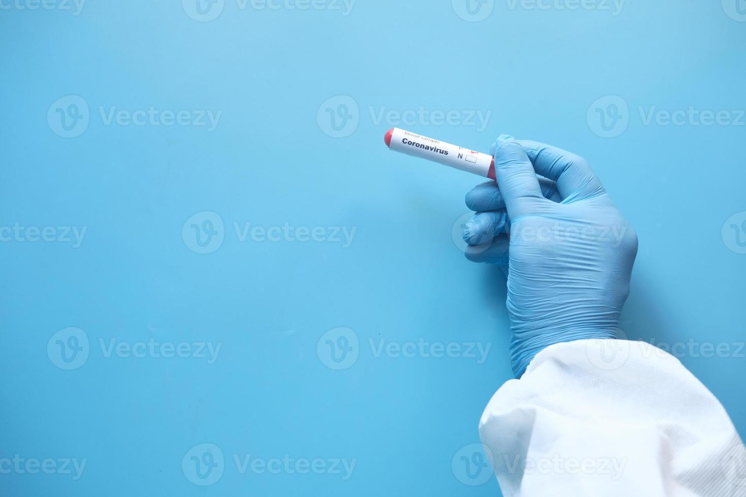 Técnico de laboratorio mano sujetando el tubo de ensayo de sangre foto