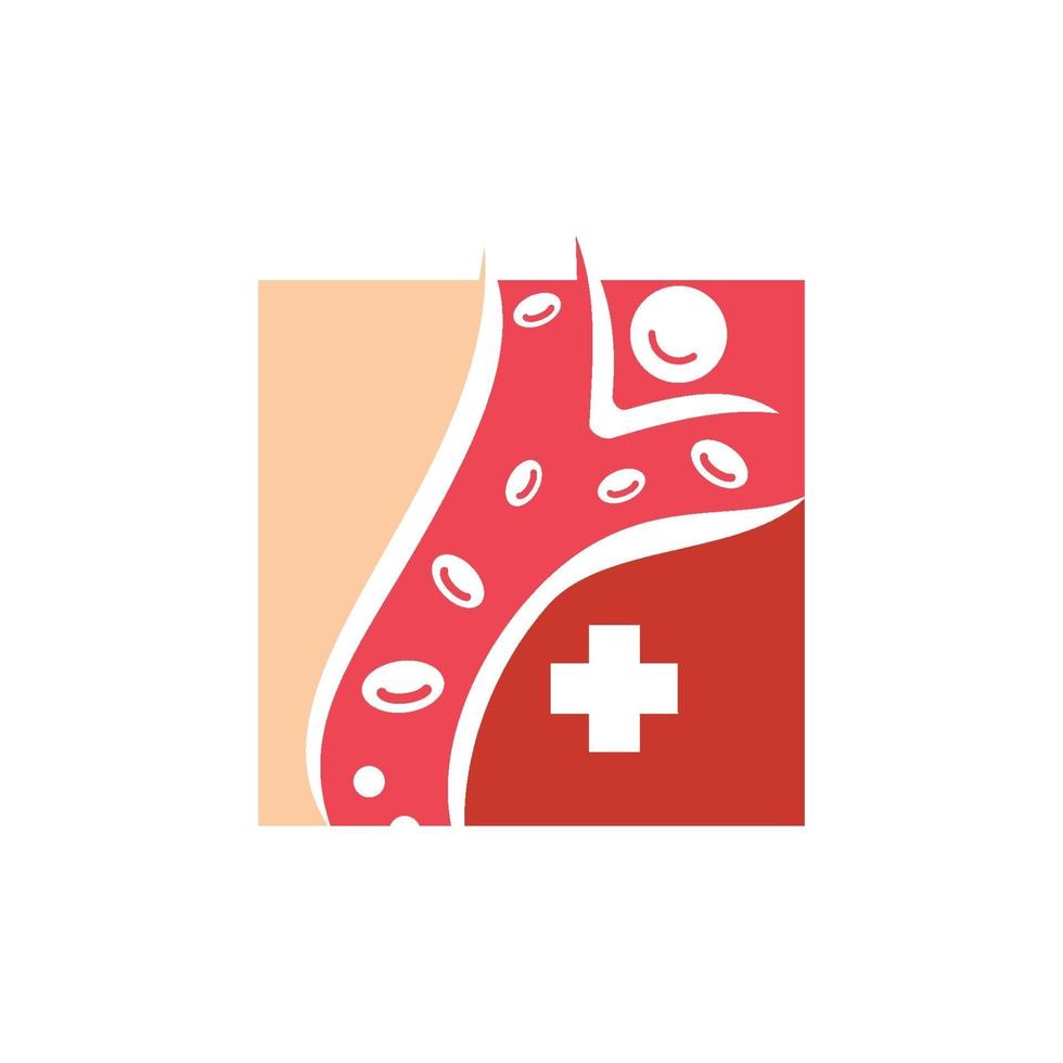 Cholesterol in artery health risk vector design Illustration