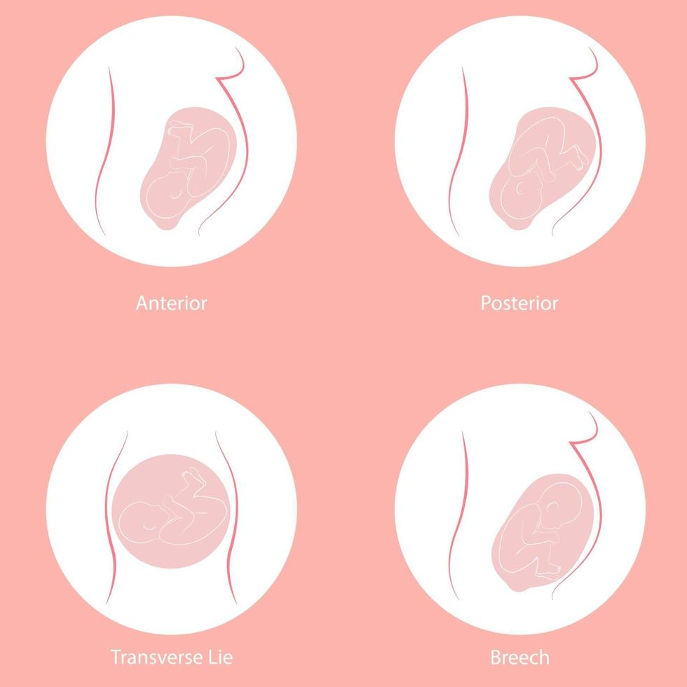 Baby position in the womb. vector