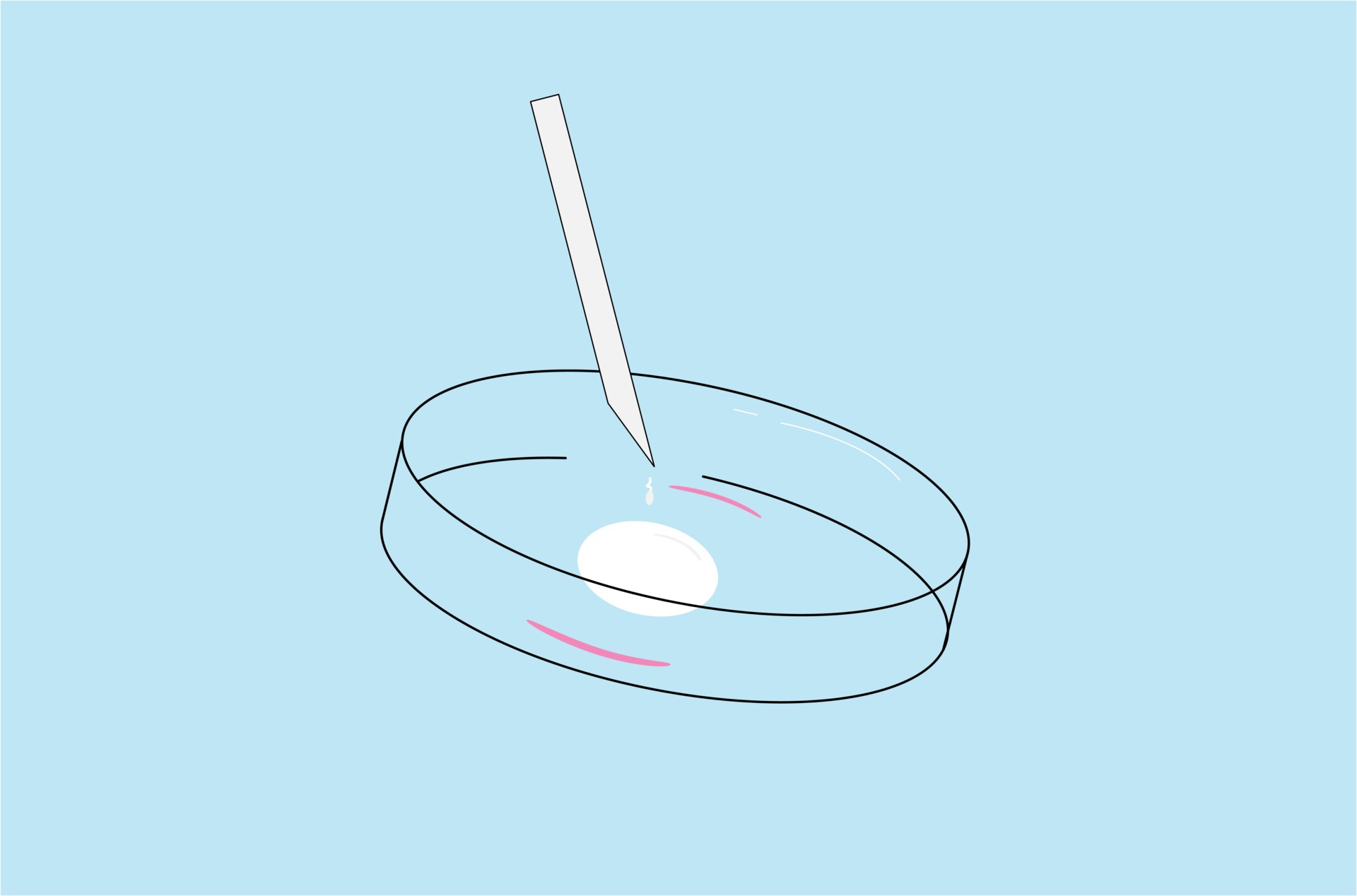 Vector Illustration Of In Vitro Fertilization Or Ivf Process 2204104 Vector Illustration Of In Vitro Fertilization Or Ivf Process 2204104