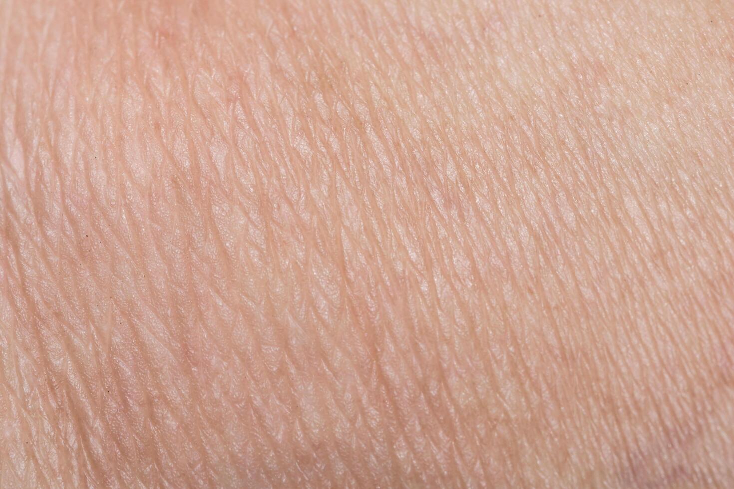 Close up of human skin photo