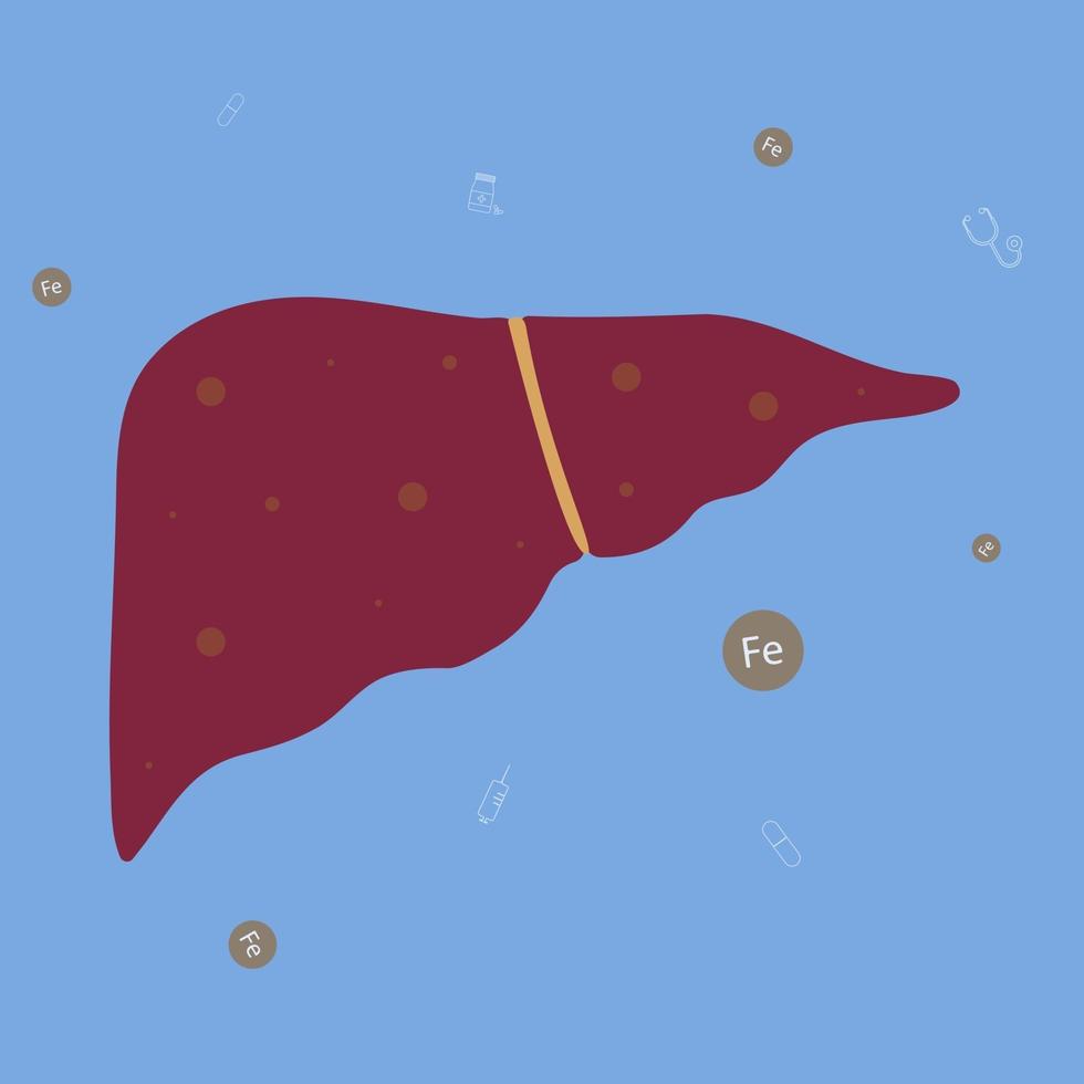 Liver with iron overload or Hemochromatosis. vector