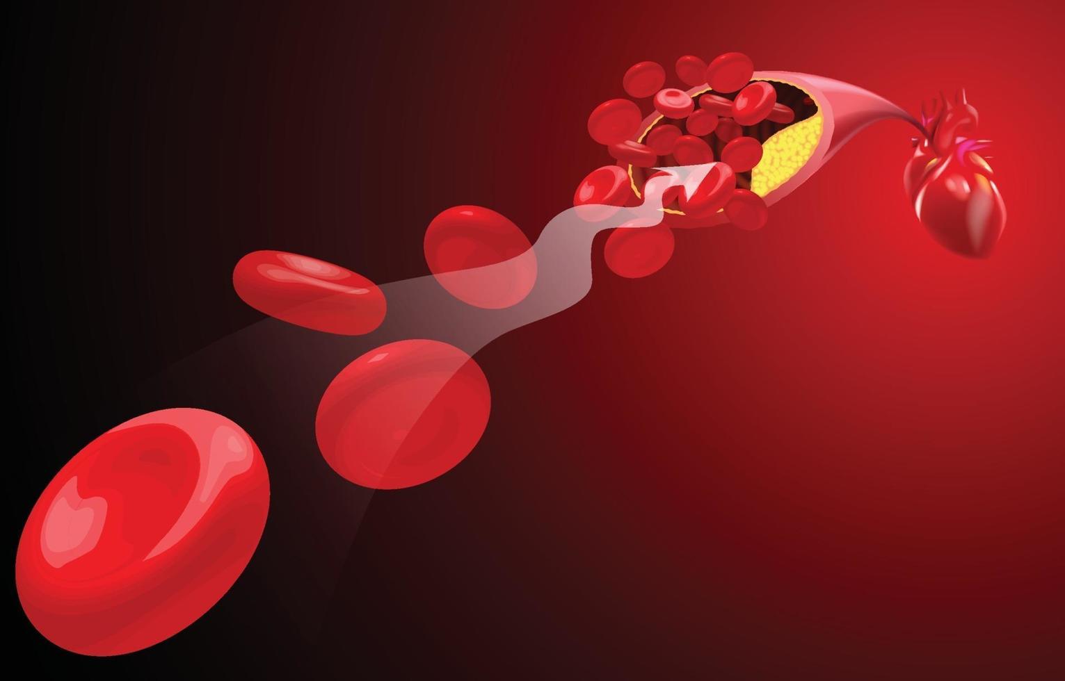 el ateroma bloquea el flujo de glóbulos rojos. vector