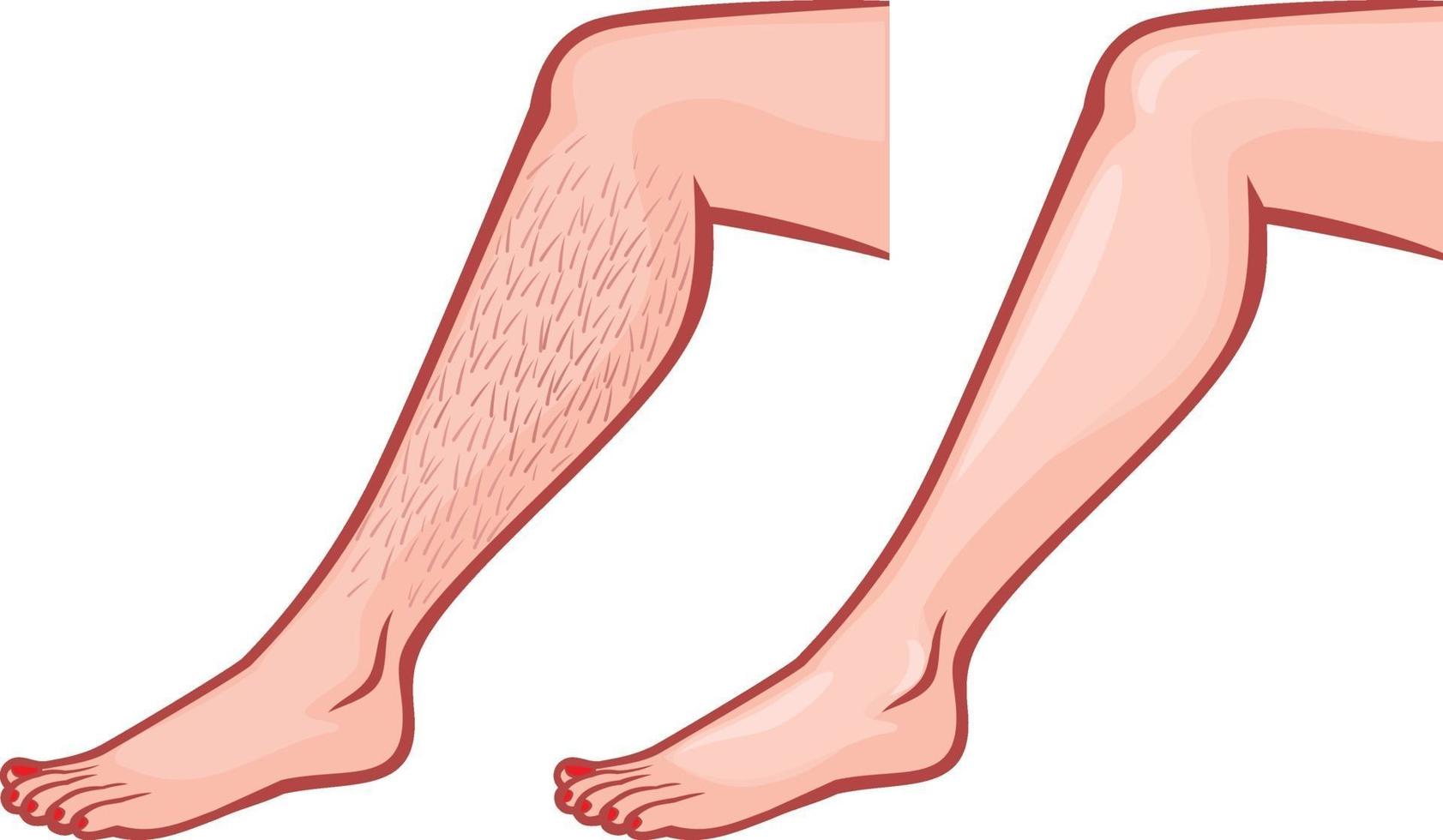 pierna antes y después de la depilación vector