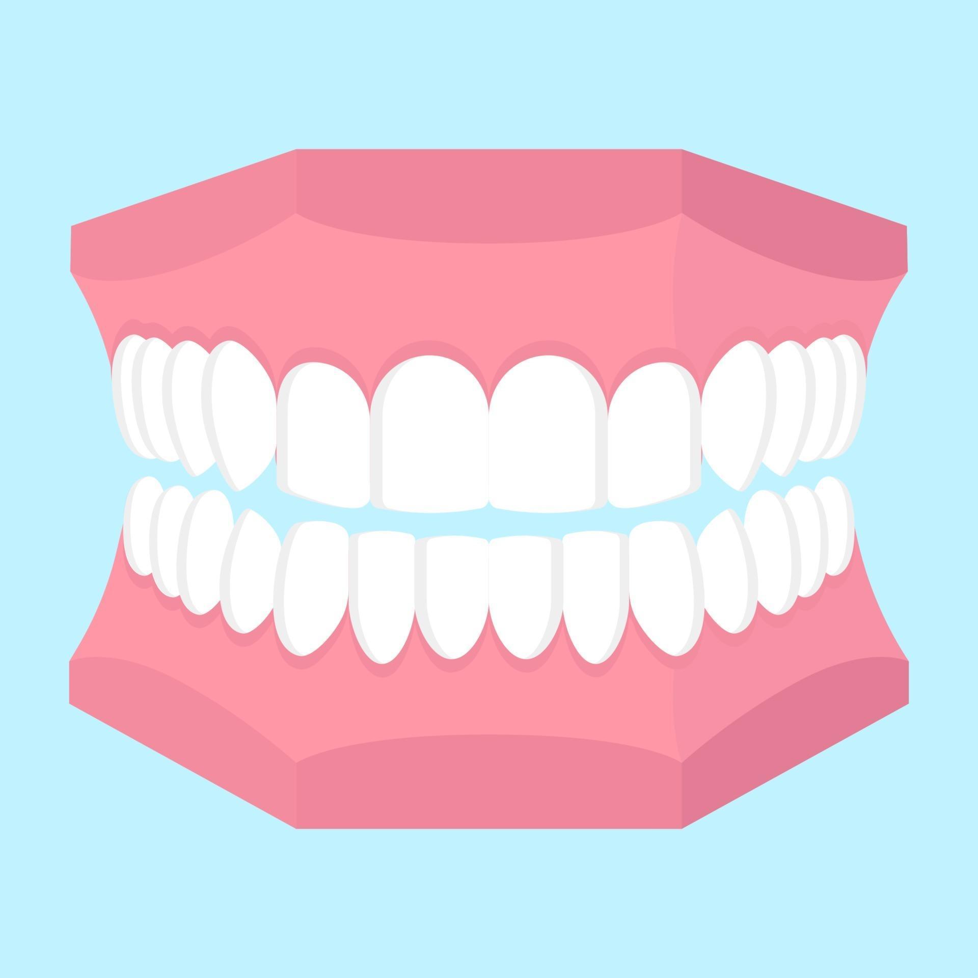 Vector cartoon illustration of dental jaw model isolated on blue