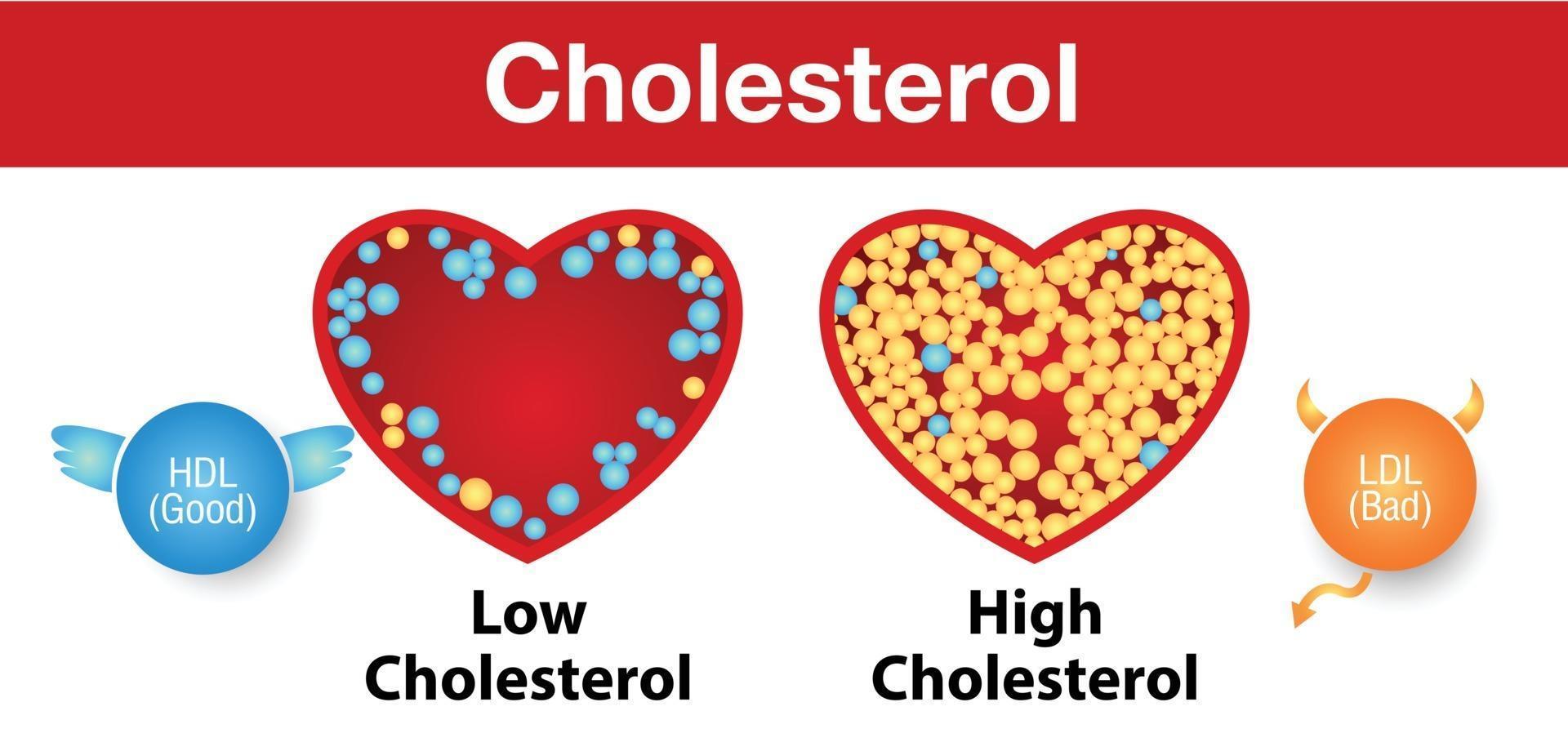 colesterol en las arterias y riesgo para la salud vector