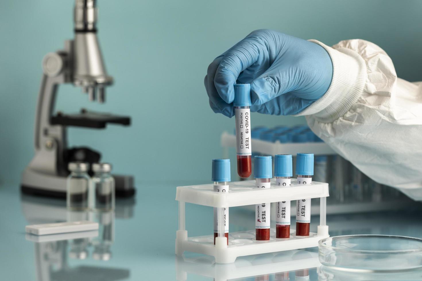 Hand with protective gloves holding a blood samples for covid test photo