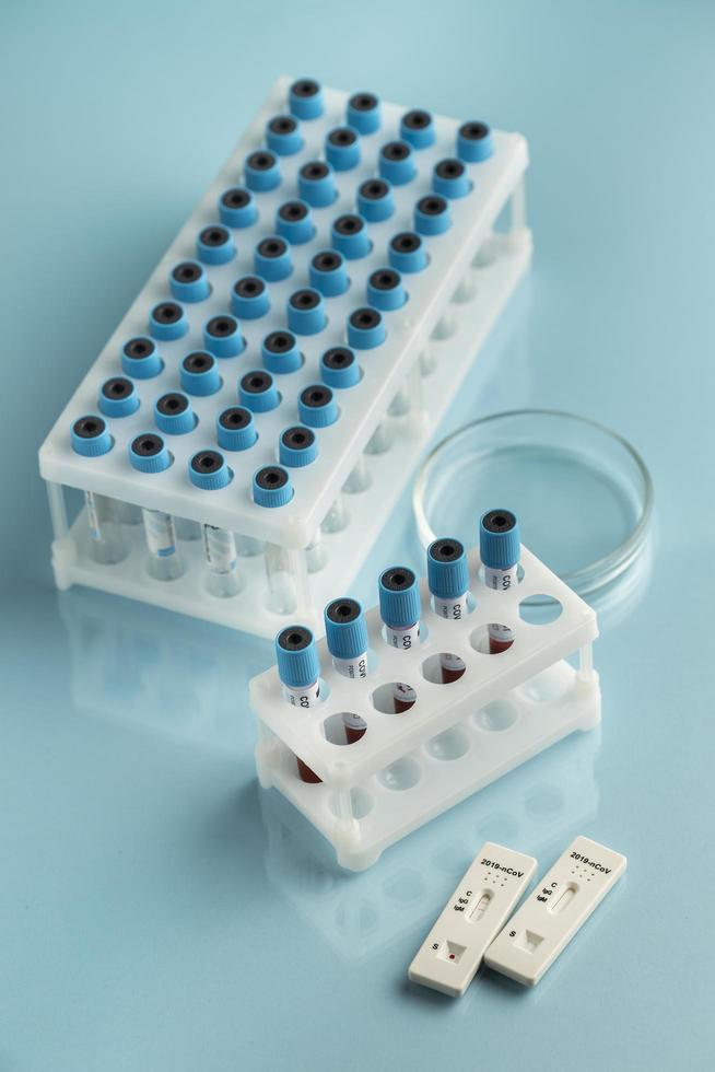 Blood samples for covid test in lab photo