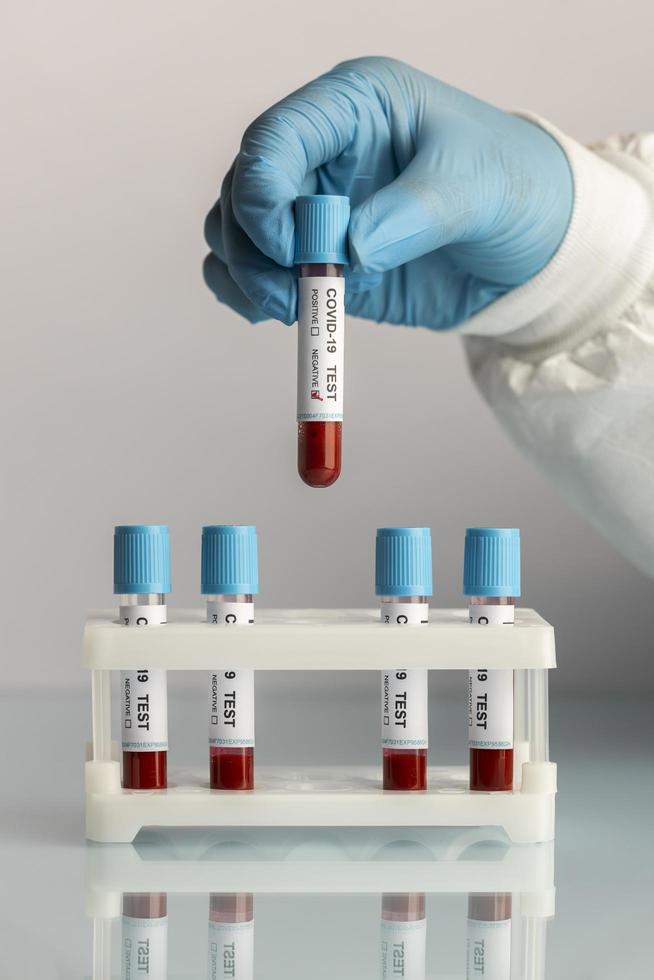 Mano con guantes protectores sosteniendo una muestra de sangre para prueba covid foto
