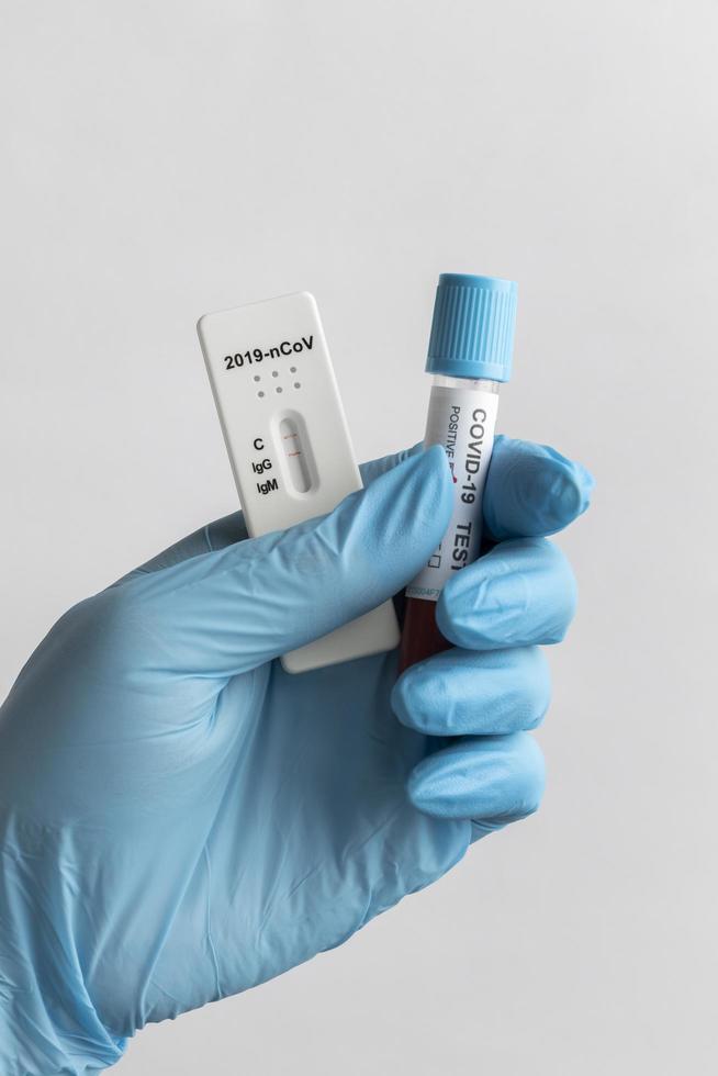 Hand with protective gloves holding a blood sample for covid test photo