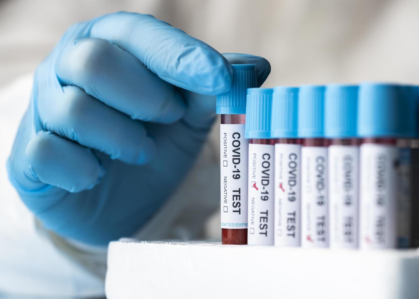 Hand with protective gloves holding a blood samples for covid test photo