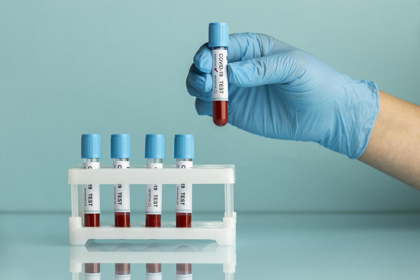 Hand with protective gloves holding a blood samples for covid test photo