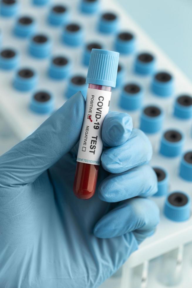 Hand with protective gloves holding a blood sample for covid test photo