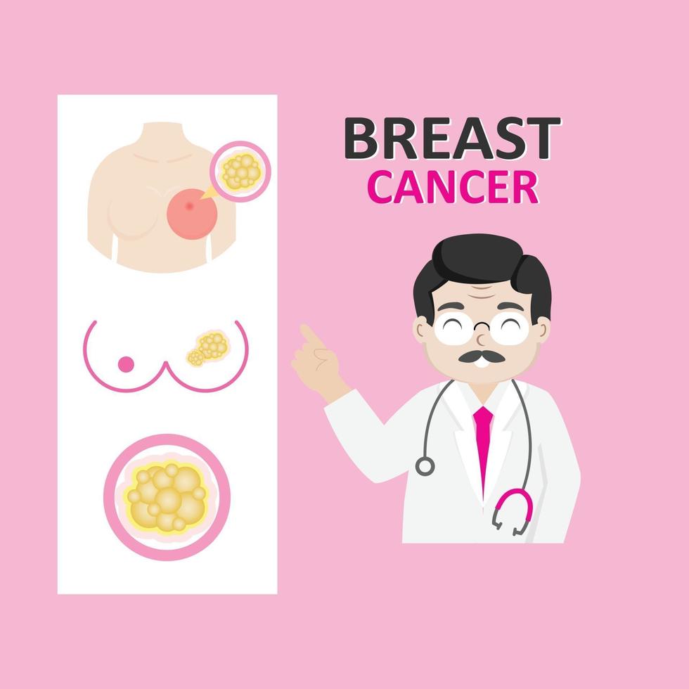 Breast cancer infographics with doctor vector