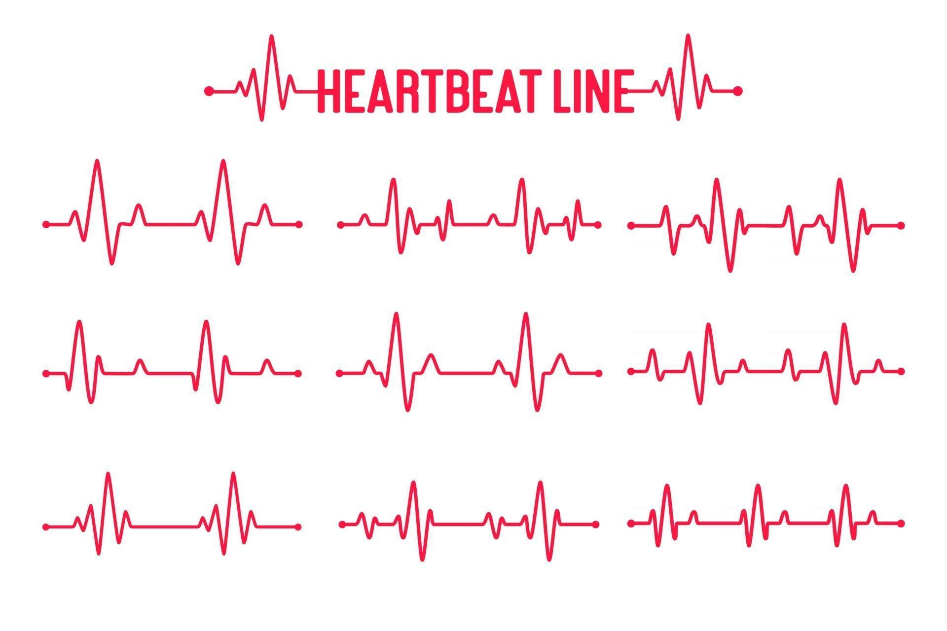 Heartbeat graph vector set Concept of helping patients and exercising