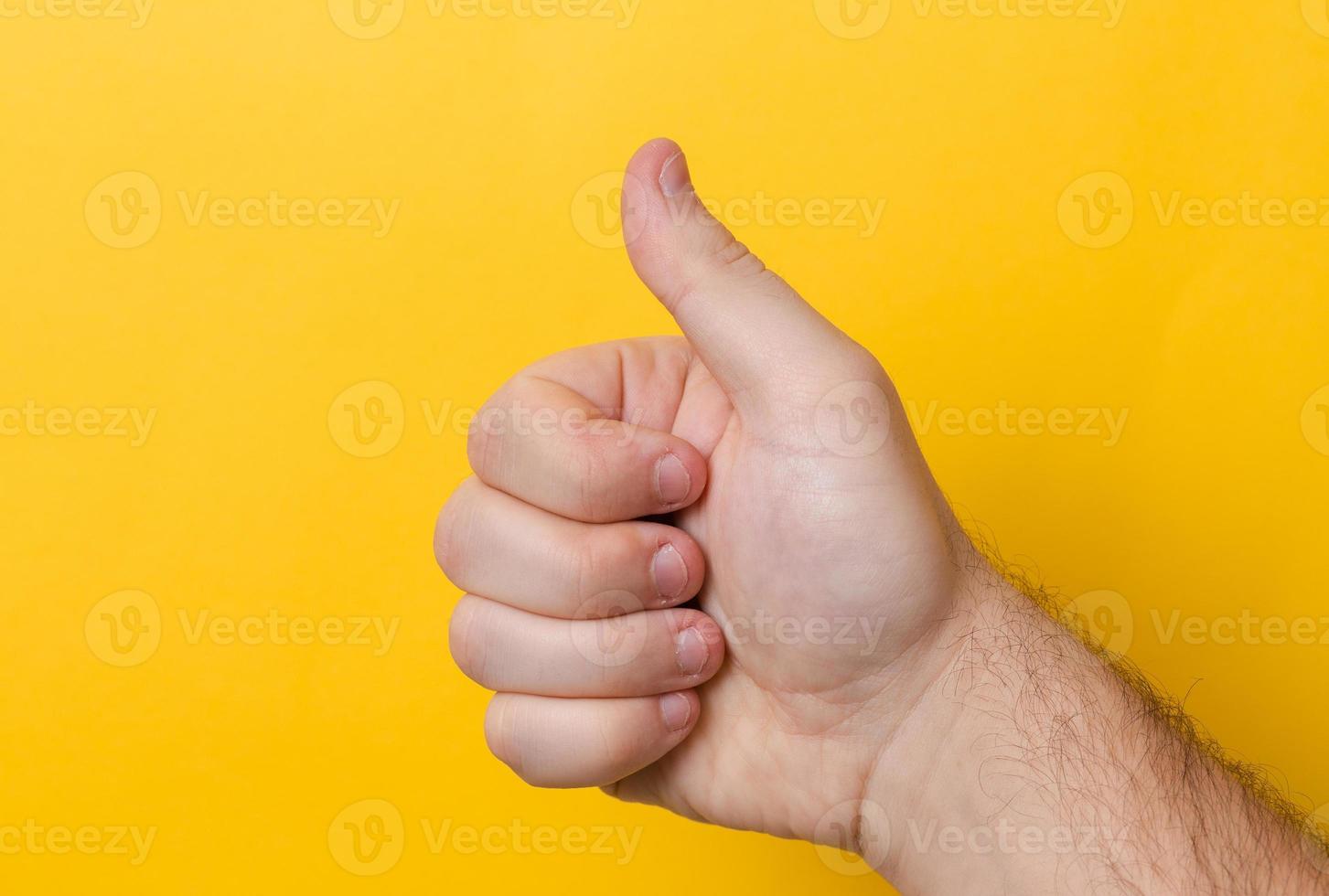 Fingers with bitten nails isolated on a yellow background photo