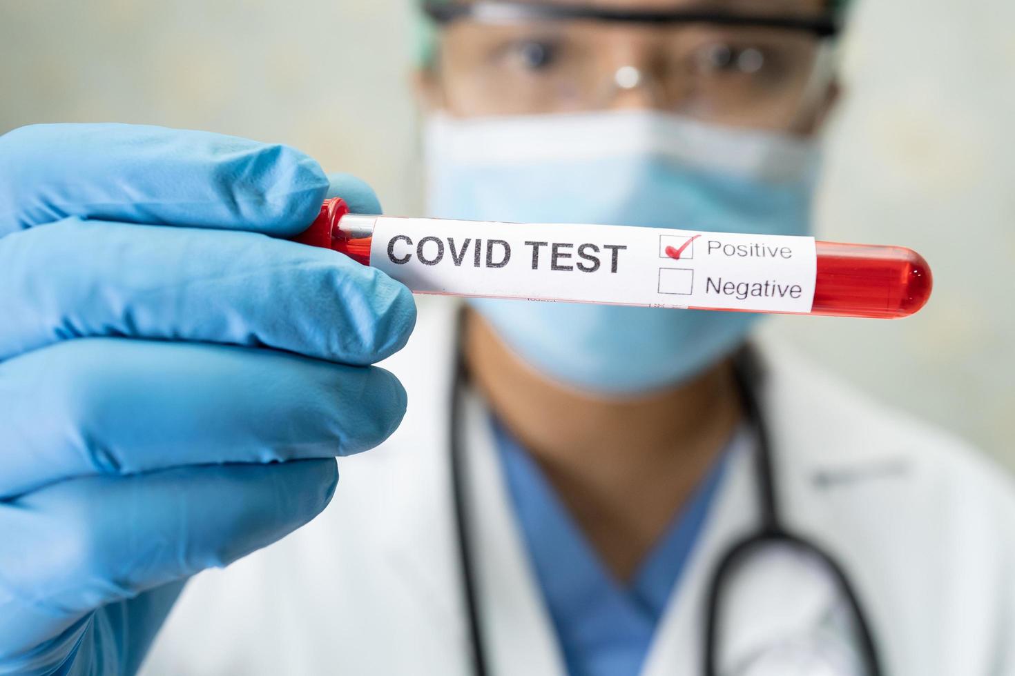 Positive blood infection sample in test tube for covid 19 coronavirus in lab photo