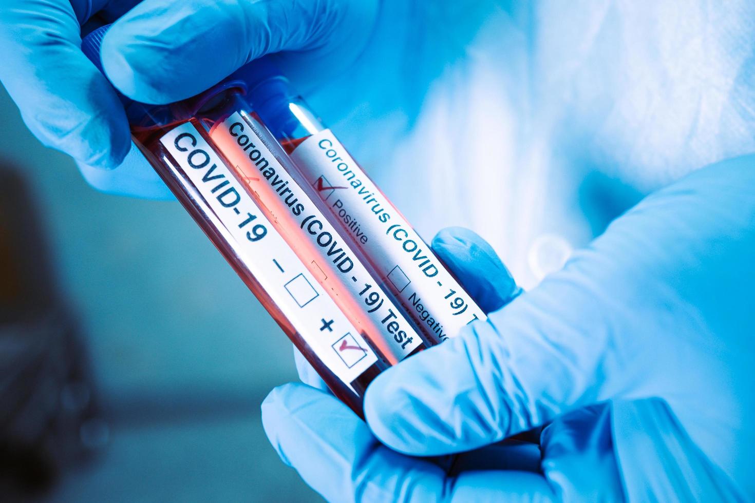 Positive blood infection sample in test tube for covid 19 coronavirus in lab photo