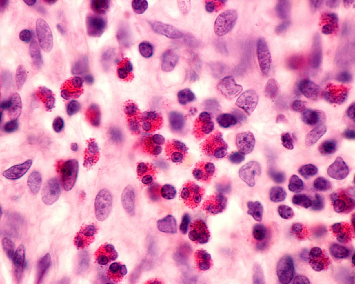 eosinófilos leucocitos granulocitos foto