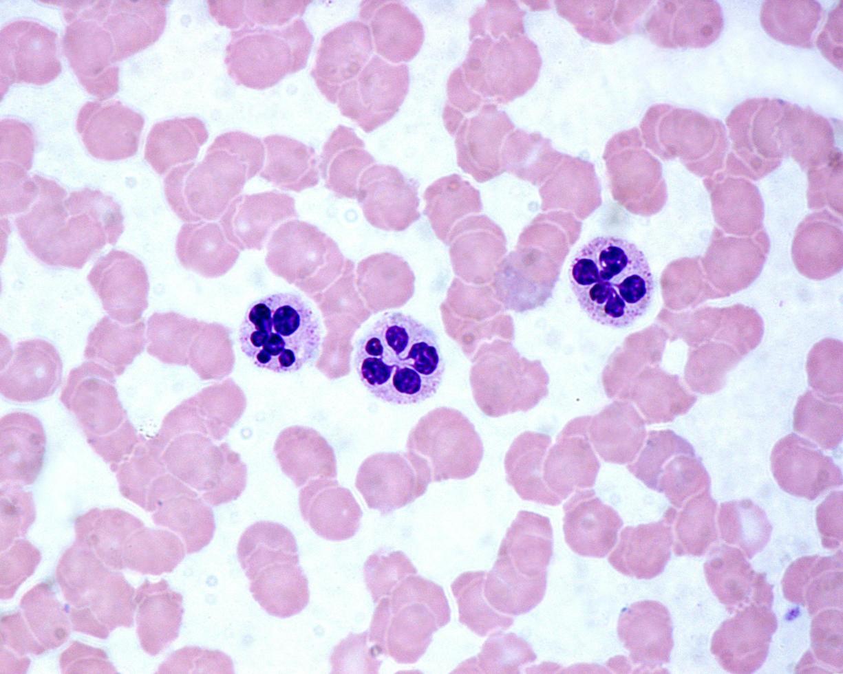 Neutrophils Blood smear photo