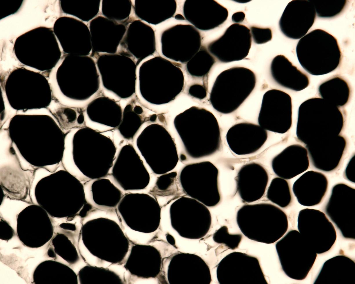 Adipocytes osmium tetroxide photo