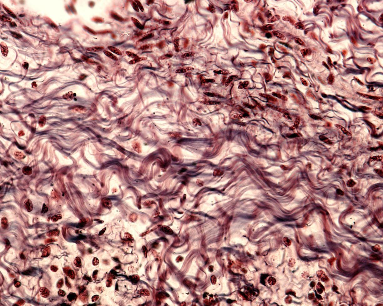 Collagen fibers Connective tissue photo