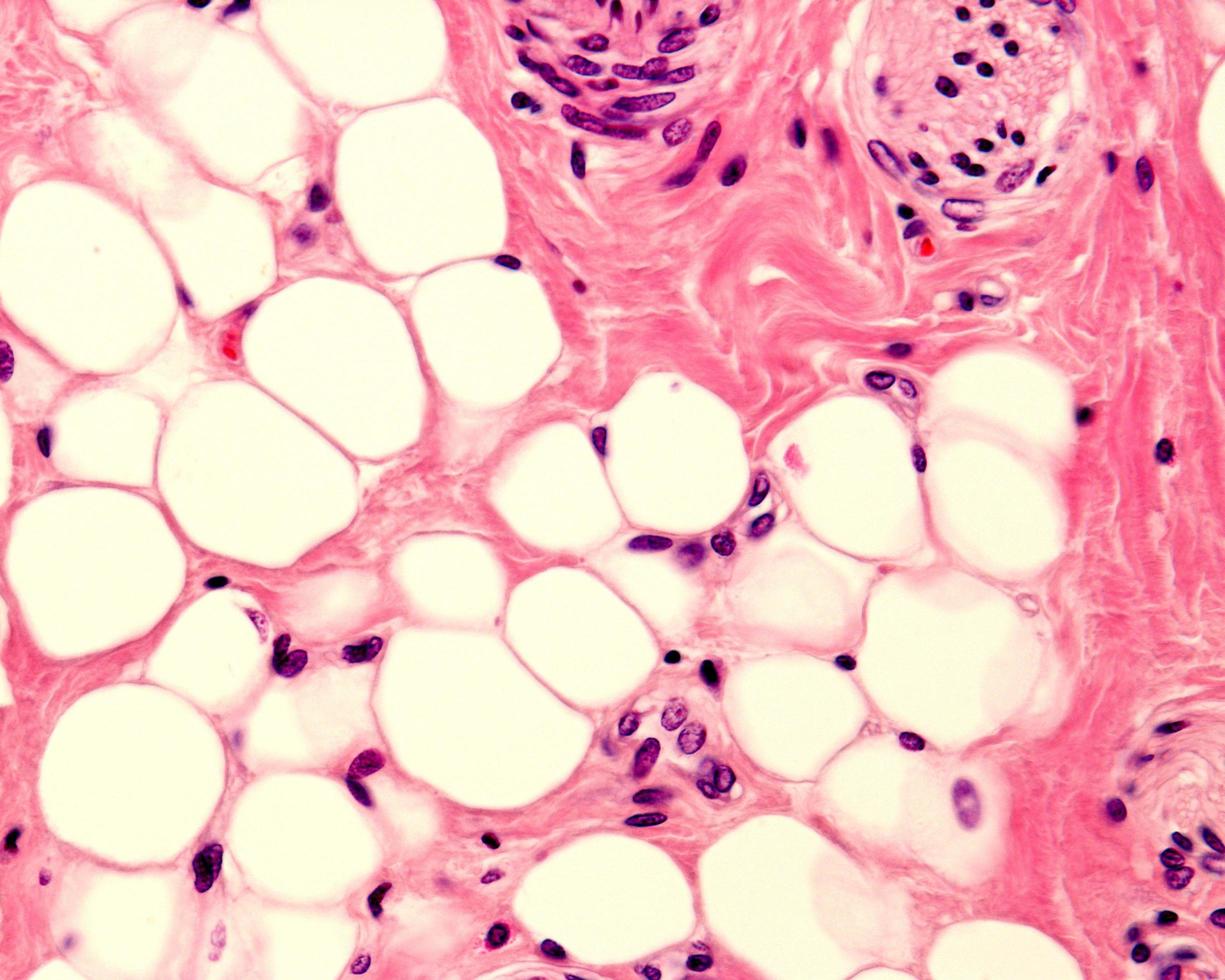 Adipose tissue human photo
