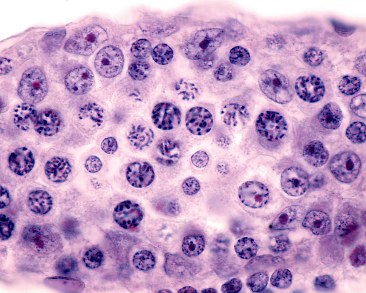 Seminiferous tubule Epithelium photo