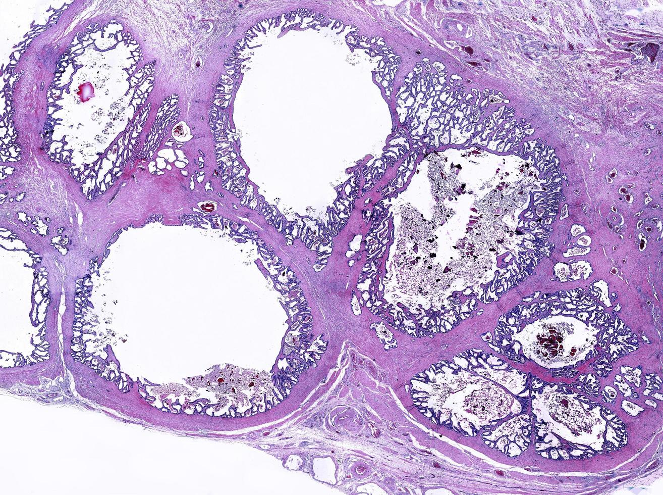 Seminal vesicle human photo