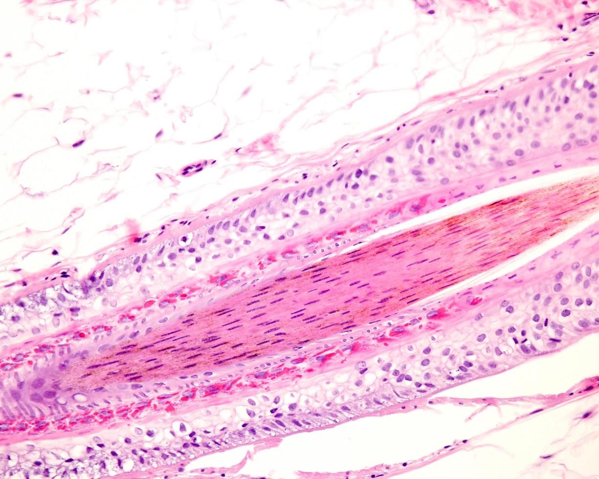 Human hair follicle photo