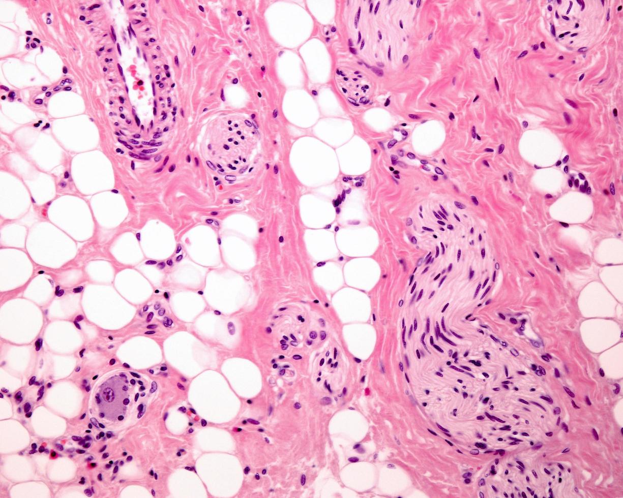 Adipose tissue human photo