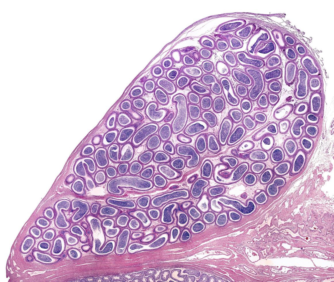 Human epididymis duct photo