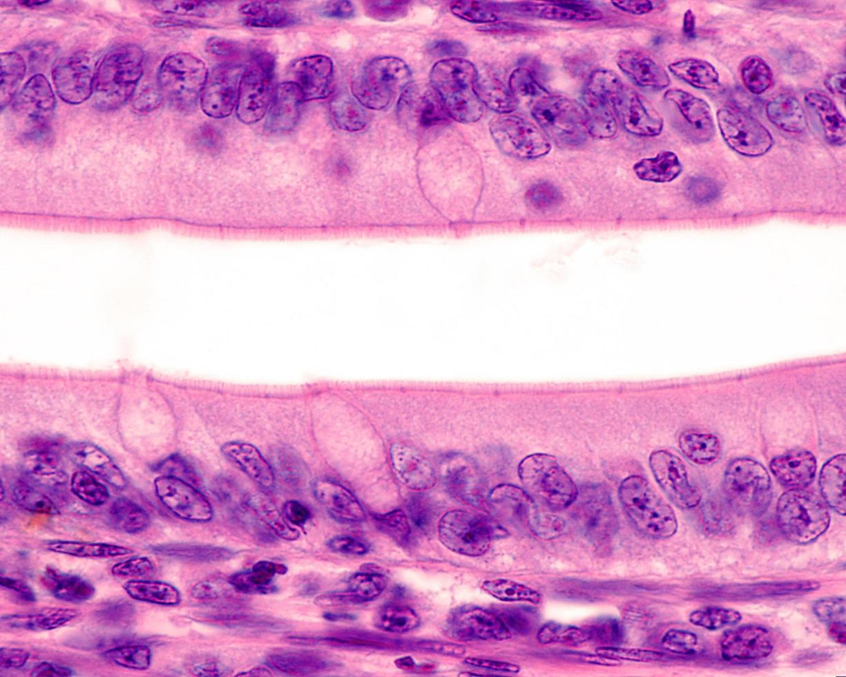 epitelio del intestino delgado foto