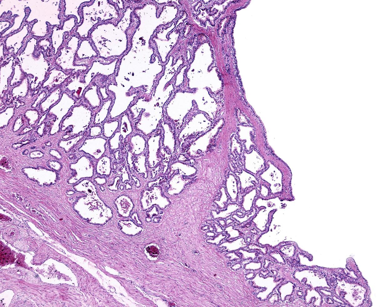 Human seminal vesicle photo