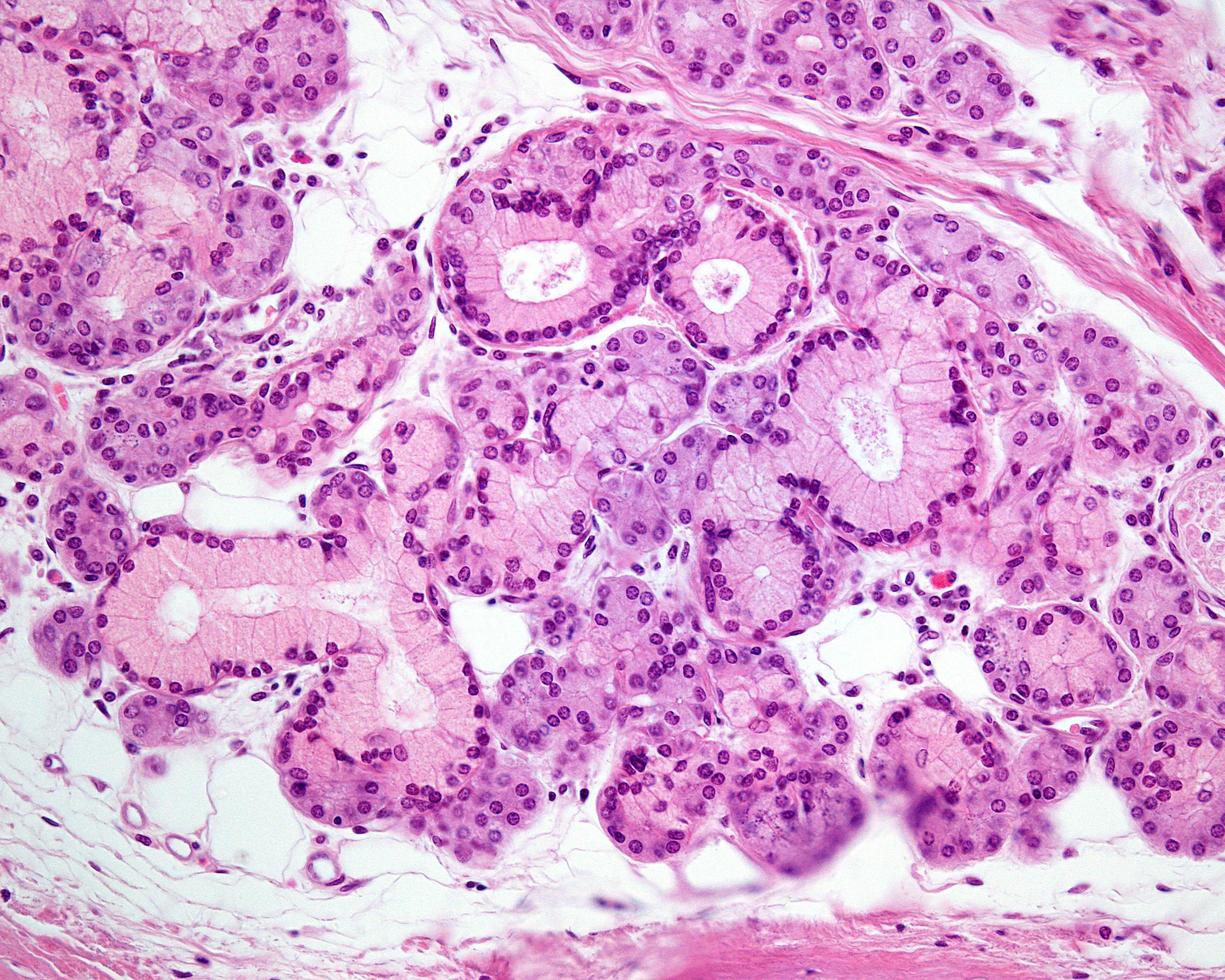 Mixed exocrine gland photo