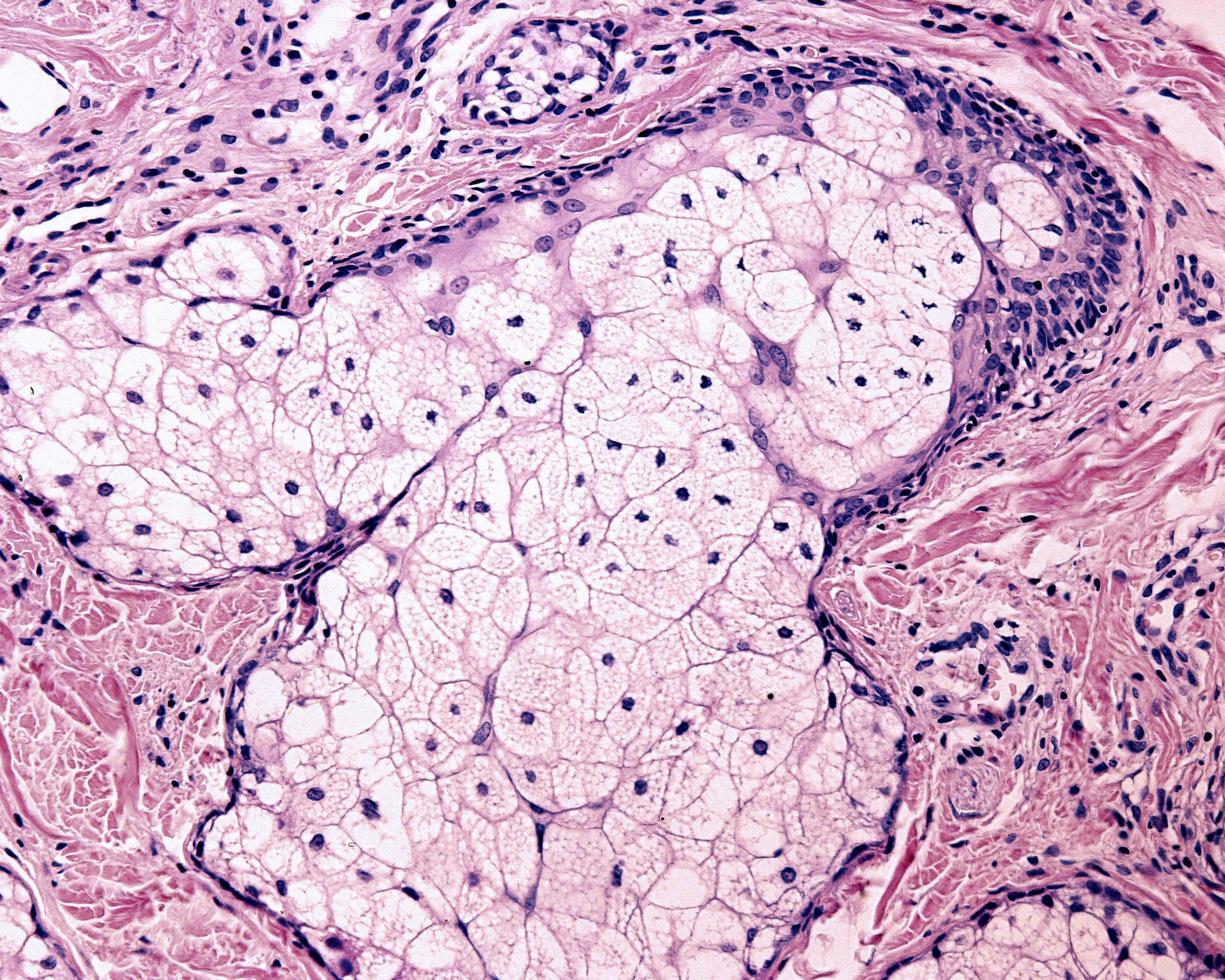 Sebaceous gland human photo