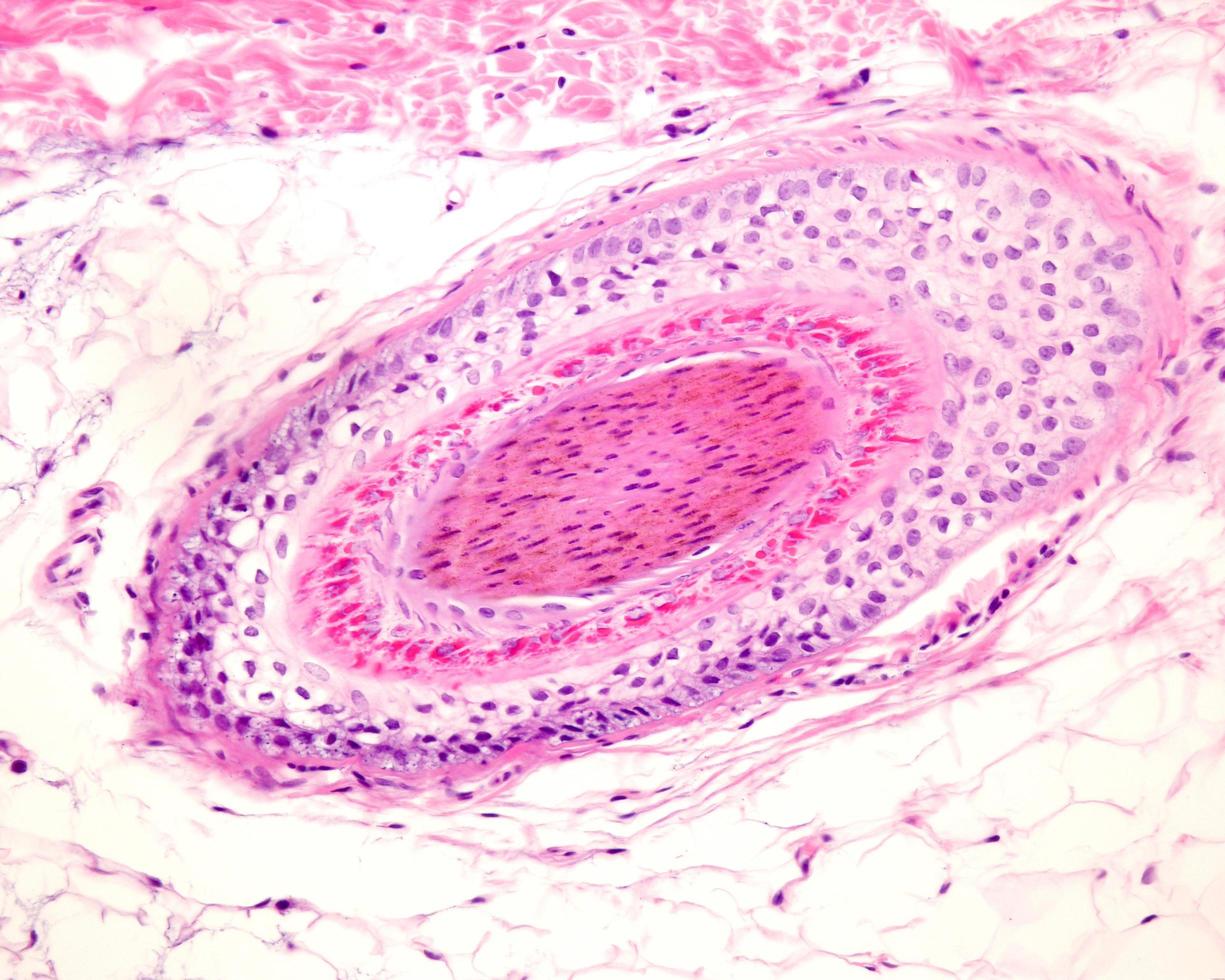 Human hair follicle photo