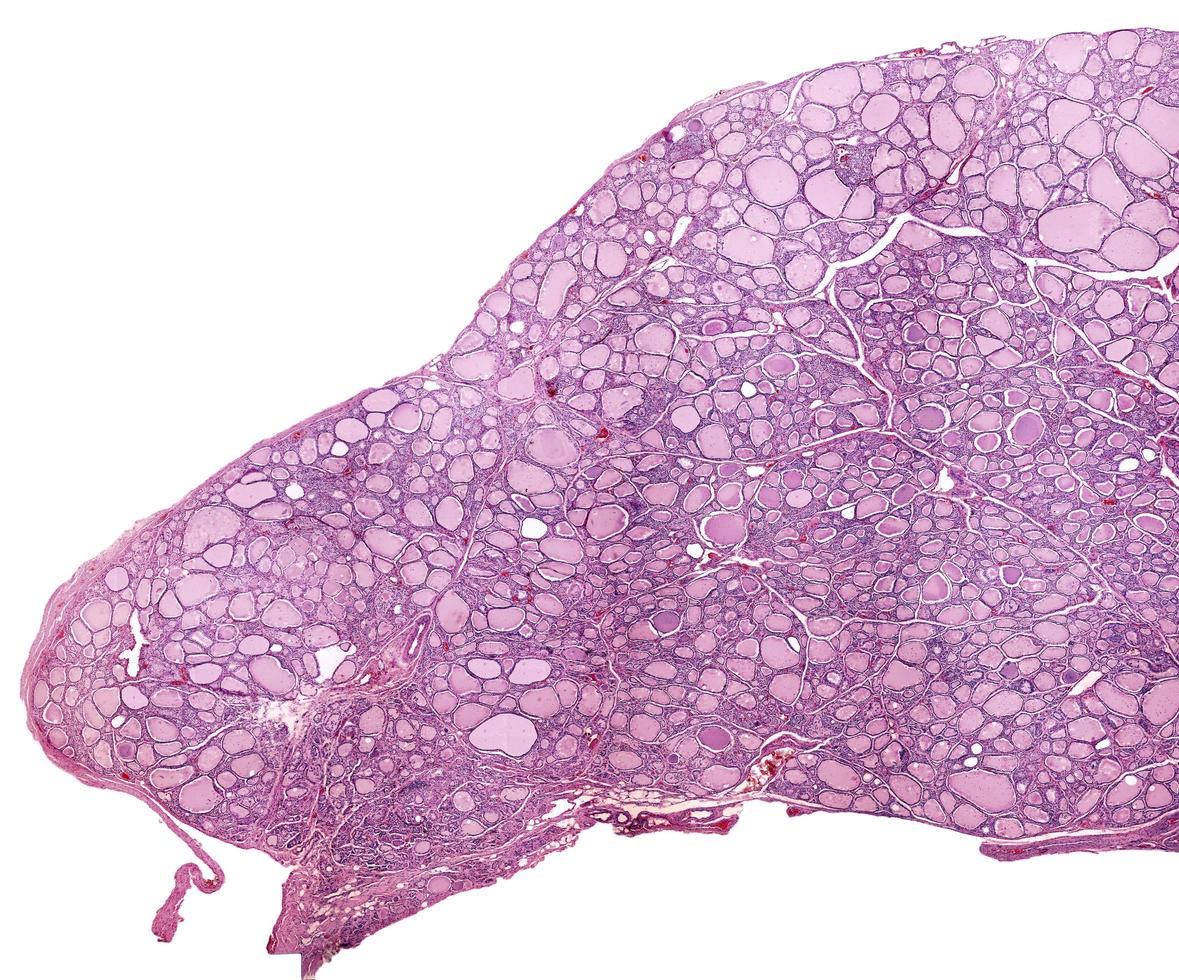 Thyroid follicles human photo