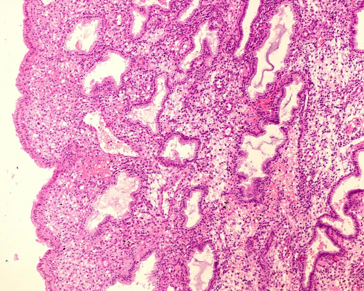 Endometrium Secretory phase photo