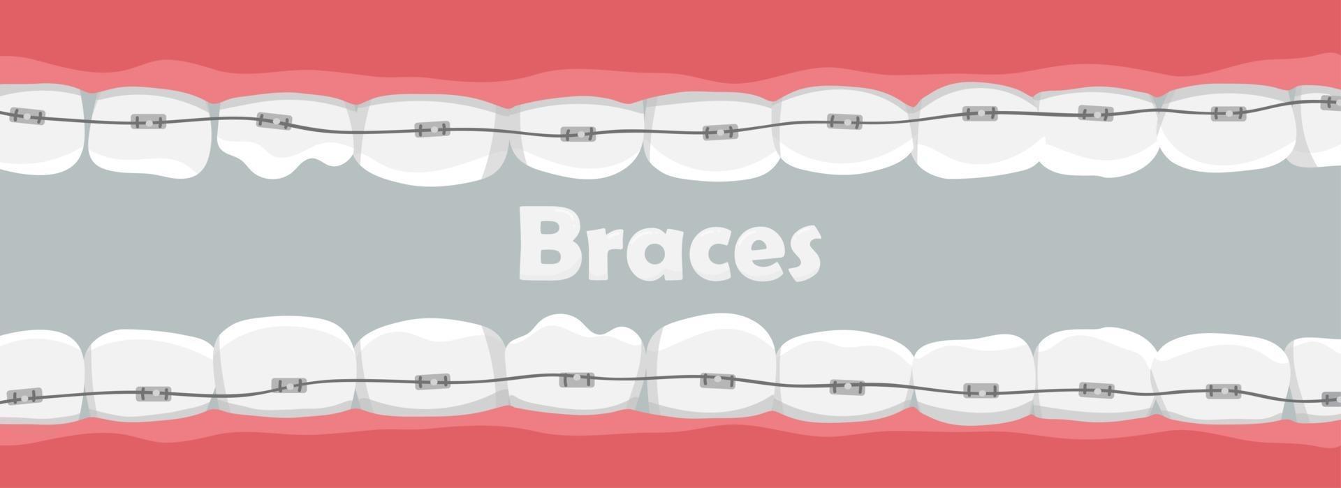 Banner with teeth with braces vector