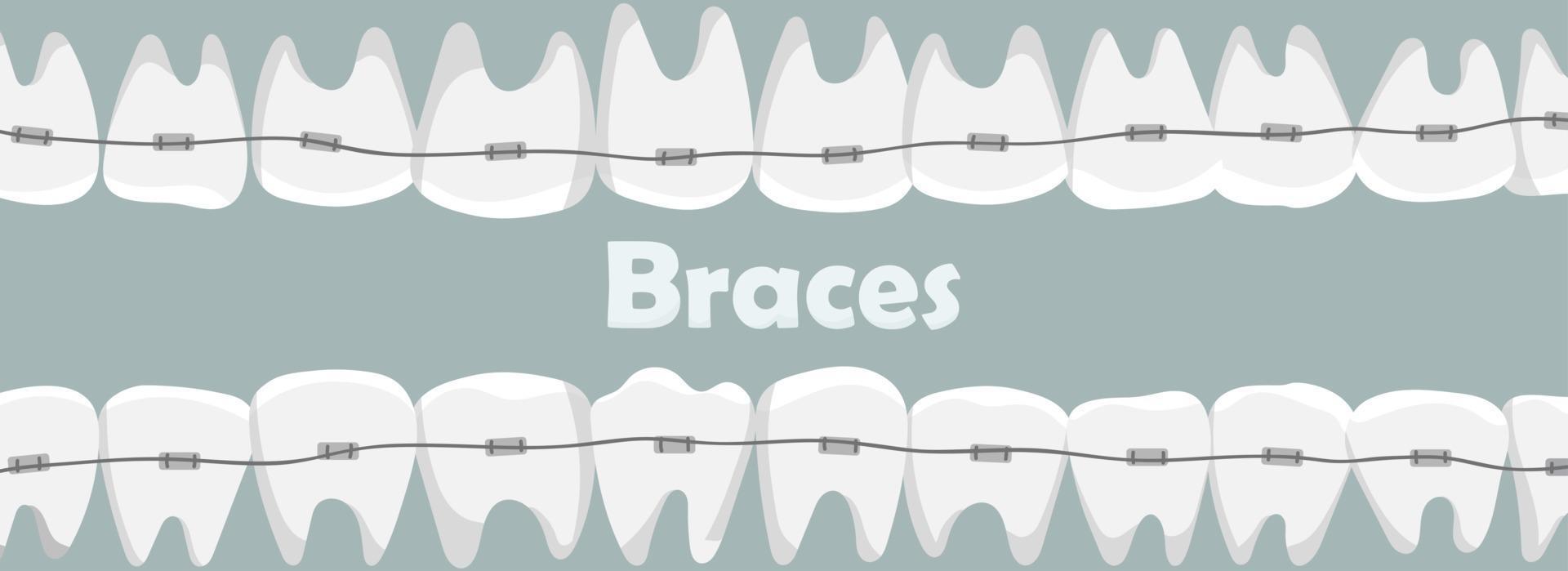 Banner with teeth with braces vector