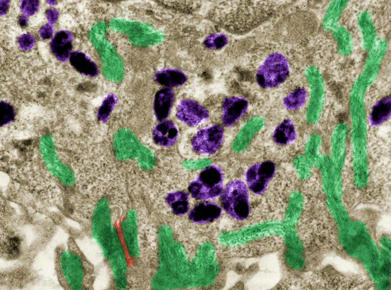 Melanin granules in skin cell False colour TEM photo