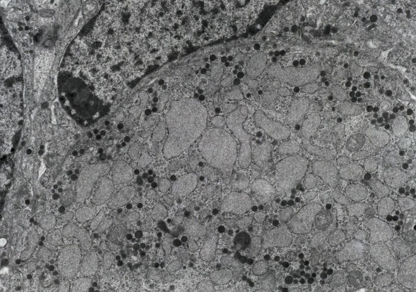 Gonadotropic cell TEM photo