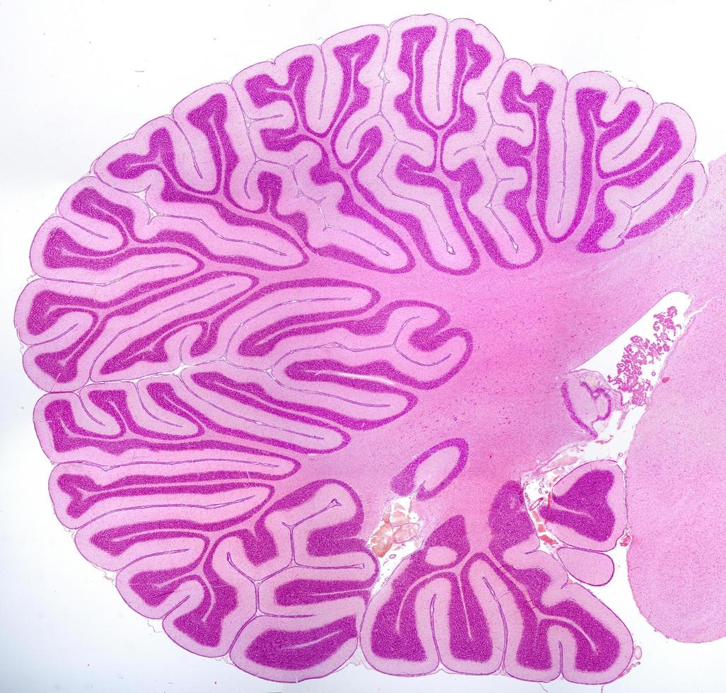 Cerebellum Sagittal section photo