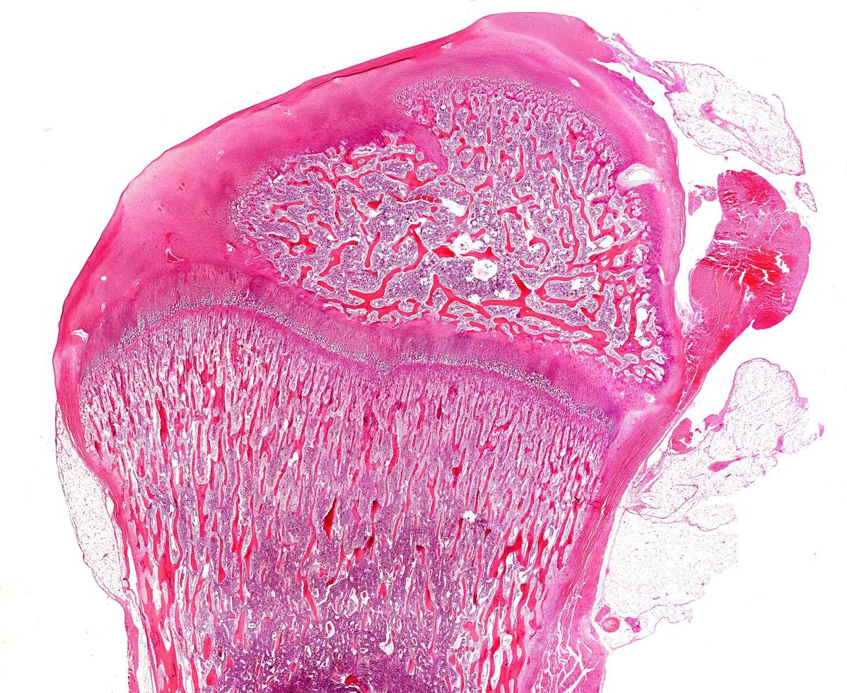 Developing long bone Growth plate photo