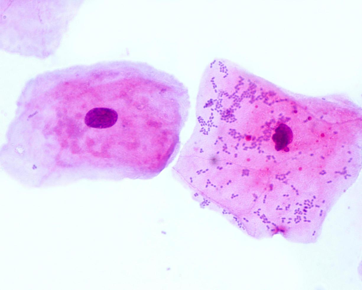 Squamous epithelial cells photo