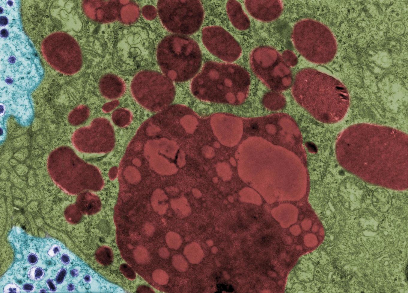 Lysosomes and lipofuscin False colour TEM photo