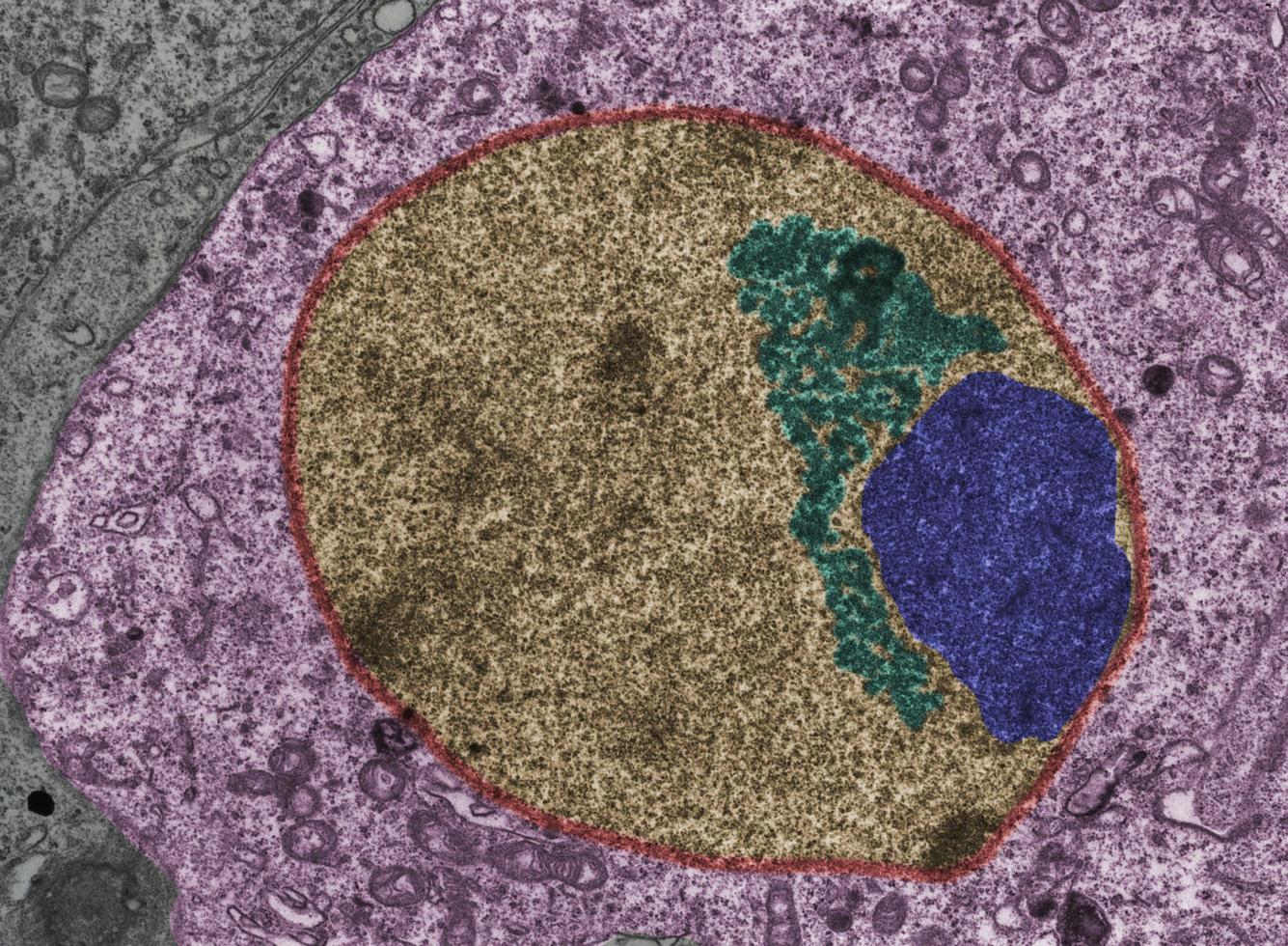 Sex vesicle False colour TEM photo