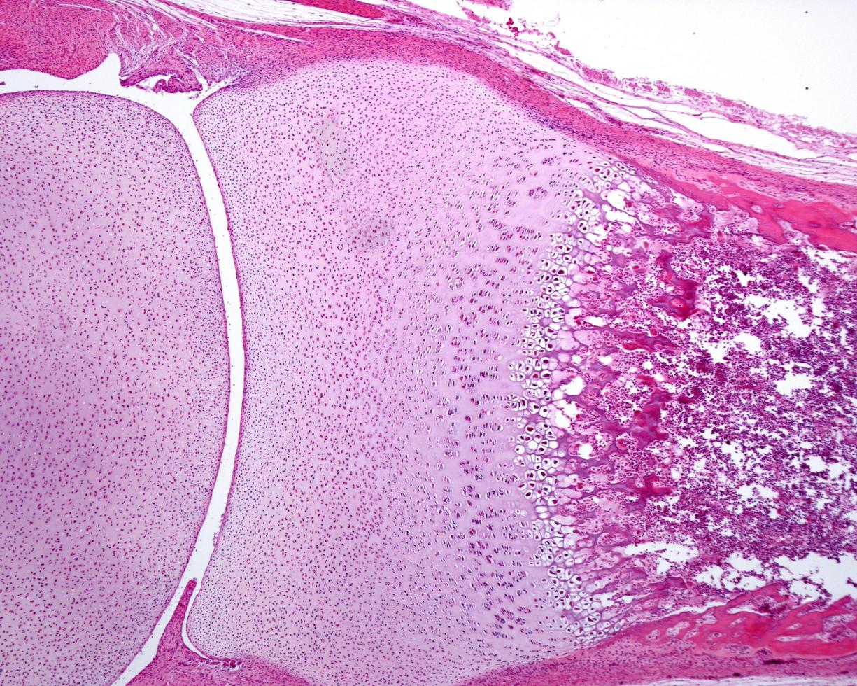 Developing bone joint photo